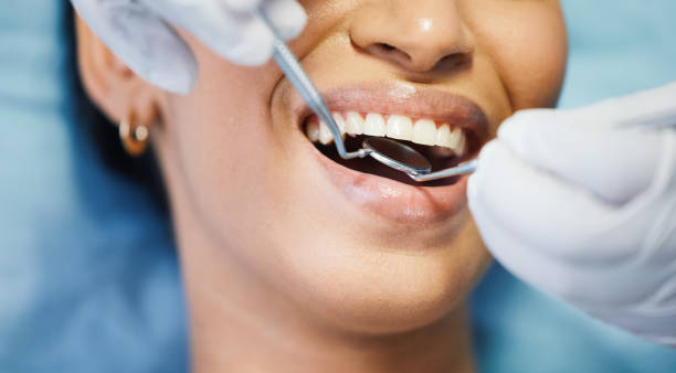 Best Knocked-Out Tooth (Avulsed Tooth) Treatment in Paintsville, KY